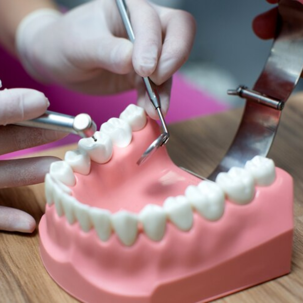 dental crowns demo