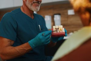 dental implants ways